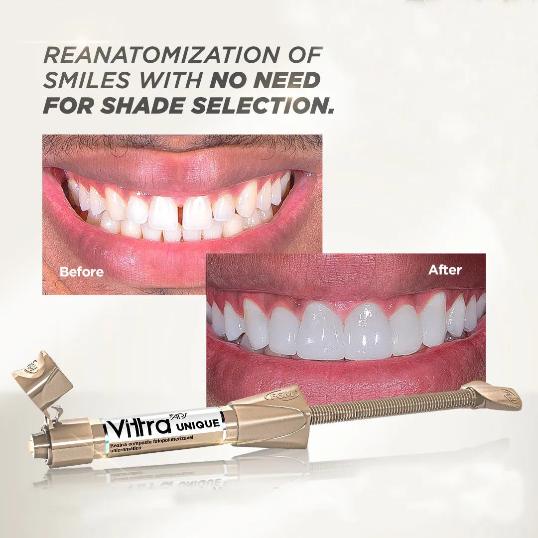 Fgm vittra universal chroma 2g